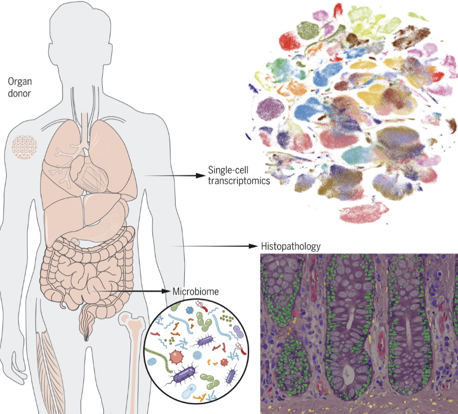Single-Cell RNA Sequencing: Why Bulk RNA-seq Hides Critical Biology